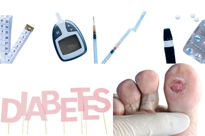 Collage mit verschiedenen Symbolen für Diabetes: Blutzuckermessgerät, Spritzen, Tabletten, Maßband, das Wort ‚Diabetes‘ in rosa Buchstaben und ein diabetischer Fuß mit einer offenen Wunde am Zeh.
